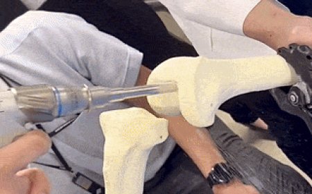 [K-Lifestyle] Reaksi Netizen Lihat Proses Operasi Penggantian Sendi: "Ruangan Operasi Ortho Tukang Kayu Banget"